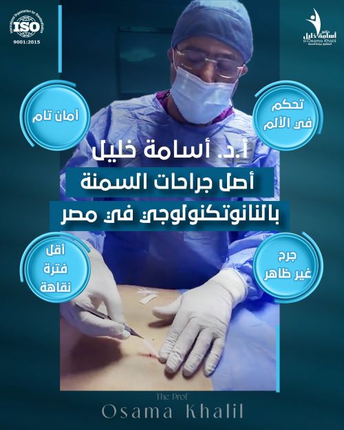 شكل جرح عملية التكميم